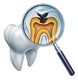 A digital illustration depicts an oral cavity with a magnified view of a tooth root showing a healthy pulp chamber, surrounded by gum tissue, viewed through a magnifying glass.