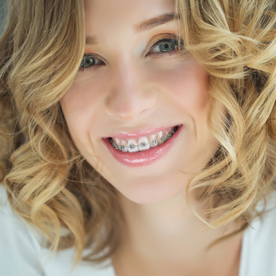 A woman with braces and a white top smiles at the camera.