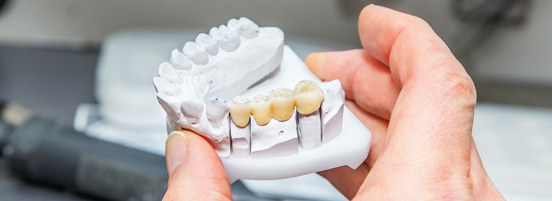 The image shows a person working on a white dental model with multiple teeth missing, using tools such as pliers and a screwdriver.