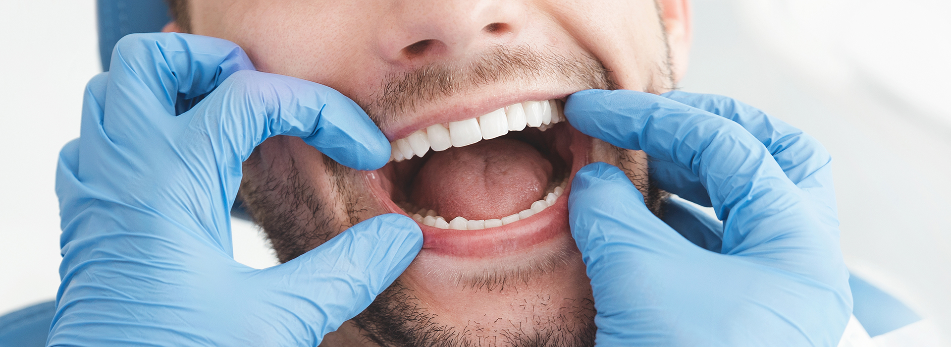 A man wearing blue gloves with his mouth open while sitting in front of a mirror, possibly in a dental office setting.