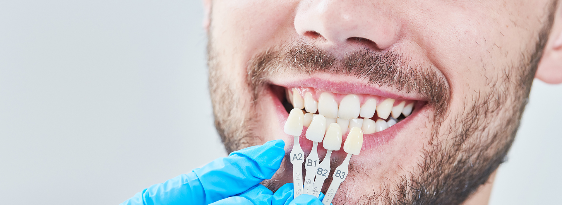 A man with a toothy smile undergoing dental treatment, wearing gloves and holding a dental instrument.