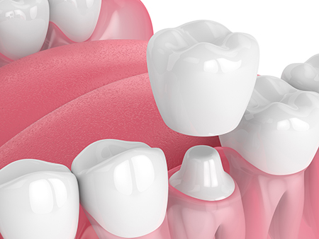 Helix Dental